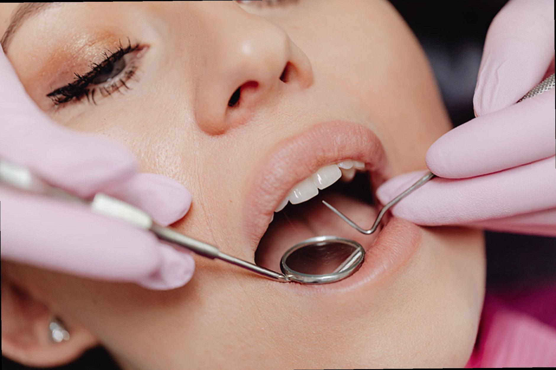 Close-Up Photo of a Woman Getting a Dental Check-Up